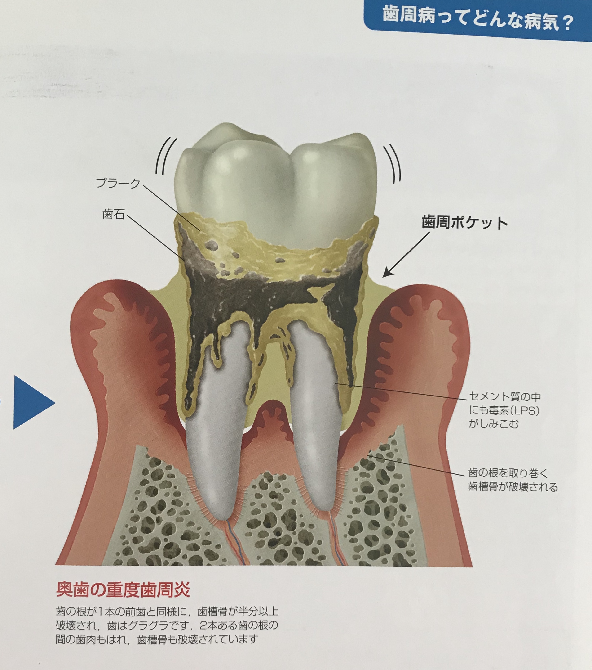 予防歯科